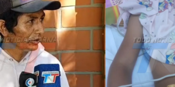 SERPIENTE CASCABEL PICA A NIÑO DE 7 AÑOS, SE ENCUENTRA EN TERAPIA INTENSIVA